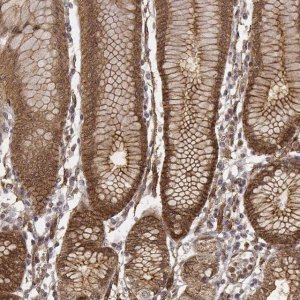 Anti-ZFYVE19 antibody produced in rabbit 