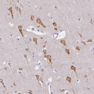 Anti-ZFYVE26 antibody produced in rabbit 
