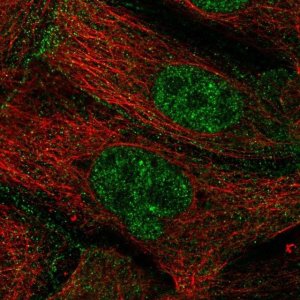 Anti-ZGPAT antibody produced in rabbit 