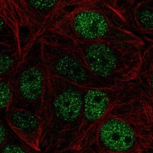 Anti-ZHX1 antibody produced in rabbit 