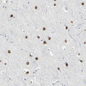 Anti-ZIC1 antibody produced in rabbit 