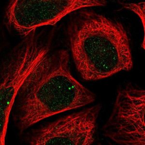 Anti-ZIC2 antibody produced in rabbit 