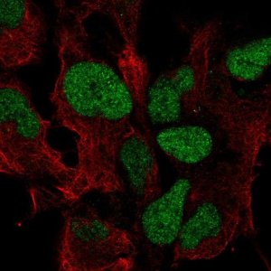 Anti-ZIC3 antibody produced in rabbit 