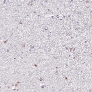 Anti-ZIC4 antibody produced in rabbit 
