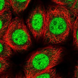 Anti-ZIC4 antibody produced in rabbit 