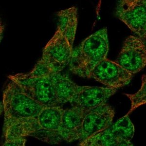 Anti-ZIM2 antibody produced in rabbit 