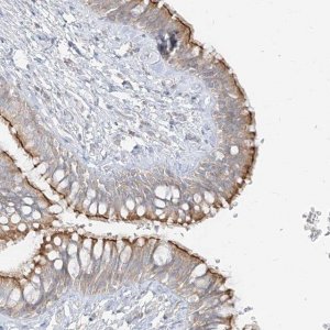 Anti-ZIM3 antibody produced in rabbit 