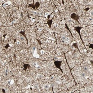 Anti-ZKSCAN1 antibody produced in rabbit 