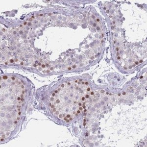 Anti-ZKSCAN2 antibody produced in rabbit 