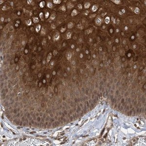 Anti-ZKSCAN5 antibody produced in rabbit 