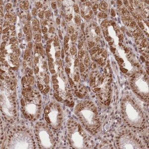 Anti-ZMAT2 antibody produced in rabbit HPA036518-100UL