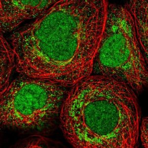 Anti-ZMAT2 antibody produced in rabbit HPA036518-100UL