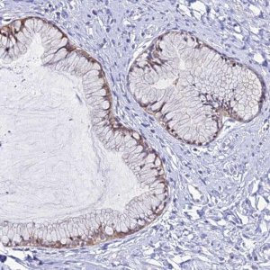 Anti-ZMIZ1 antibody produced in rabbit 