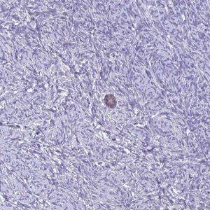 Anti-ZMIZ1 antibody produced in rabbit 