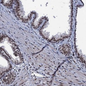 Anti-ZMIZ2 antibody produced in rabbit 