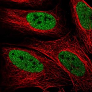 Anti-ZMYM3 antibody produced in rabbit 