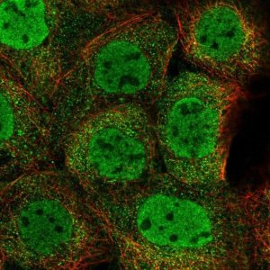 Anti-ZMYM4 antibody produced in rabbit 