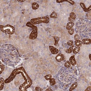 Anti-ZMYM5 antibody produced in rabbit 