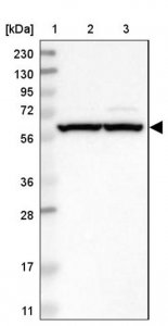 Anti-ZMYM5 antibody produced in rabbit 