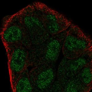 Anti-ZMYM6 antibody produced in rabbit 