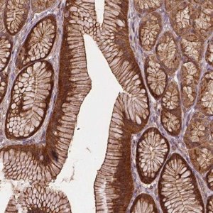 Anti-ZMYND19 antibody produced in rabbit 