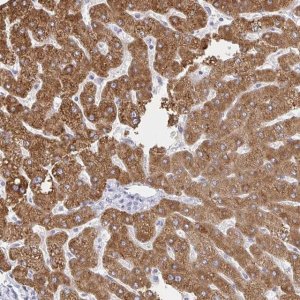 Anti-ZNF100 antibody produced in rabbit 