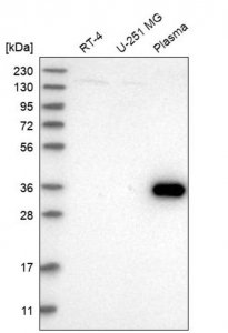 Anti-ZNF101 antibody produced in rabbit 