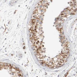 Anti-ZNF112 antibody produced in rabbit 