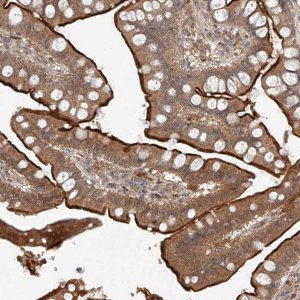 Anti-ZNF124 antibody produced in rabbit 