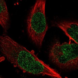 Anti-ZNF124 antibody produced in rabbit 