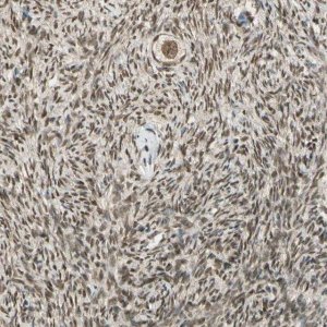 Anti-ZNF135 antibody produced in rabbit 