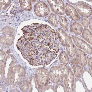 Anti-ZNF14 antibody produced in rabbit 