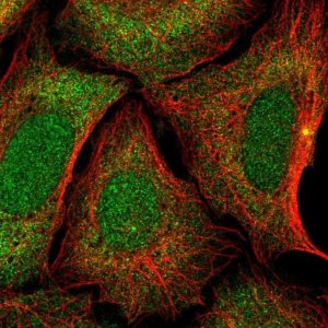 Anti-ZNF14 antibody produced in rabbit 