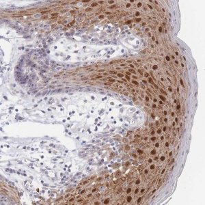 Anti-ZNF142 antibody produced in rabbit 