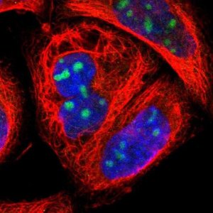 Anti-ZNF146 antibody produced in rabbit 