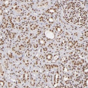 ANTI-ZNF148 antibody produced in rabbit 