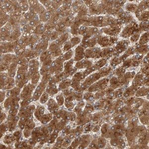 Anti-ZNF160 antibody produced in rabbit 