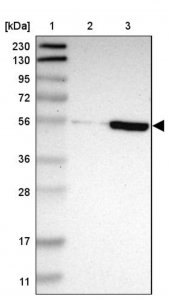 Anti-ZNF165 antibody produced in rabbit 