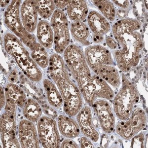 Anti-ZNF169 antibody produced in rabbit 