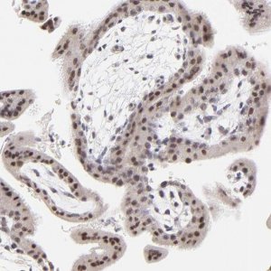 Anti-ZNF177 antibody produced in rabbit 