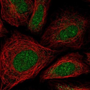 Anti-ZNF181 antibody produced in rabbit 