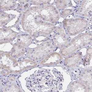 Anti-ZNF182 antibody produced in rabbit 