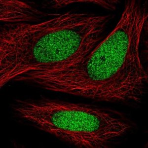 Anti-ZNF182 antibody produced in rabbit 