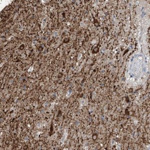 Anti-ZNF189 antibody produced in rabbit 