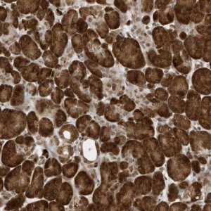 Anti-ZNF195 antibody produced in rabbit 