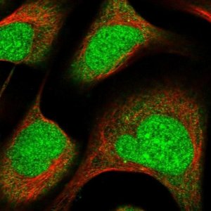 Anti-ZNF195 antibody produced in rabbit 