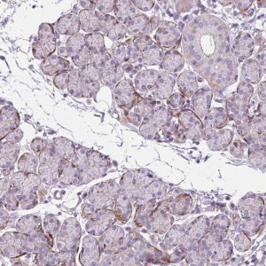 Anti-ZNF197 antibody produced in rabbit 