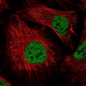 Anti-ZNF197 antibody produced in rabbit 