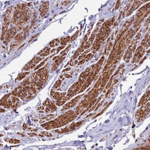 Anti-ZNF2 antibody produced in rabbit 