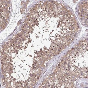 Anti-ZNF200 antibody produced in rabbit 